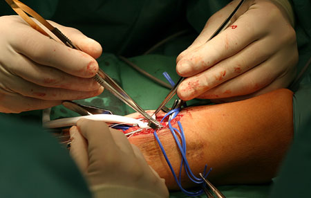 Reconstructive & Microvascular Surgery