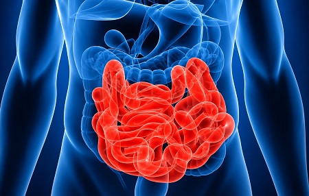 Best HIPEC Surgery in Borivali - Dr. Ramkishan Nag