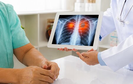 Best Lung Cancer Surgeon in Colaba - Dr. Ramkishan Nag