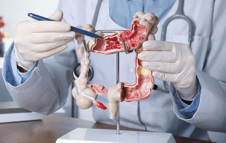 Colorectal Cancer Surgery