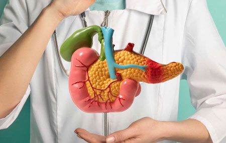 Pancreatic Cancer Surgery