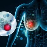 Breast Oncology Clinic In Mira Road