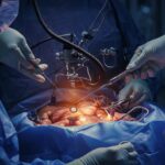 Minimally Invasive Cancer Surgery in Mira Road