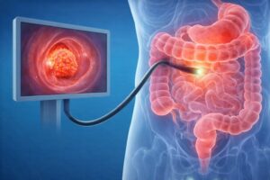 Colonoscopy And Cancer Screening In Mira Road