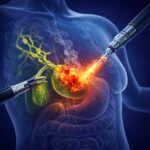 Gallbladder Tumor Treatment In Mira Road