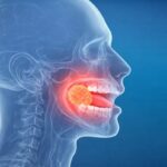 Oral Cancer Specialist In Mira Road